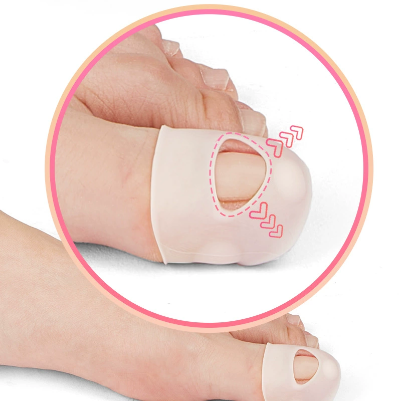 Инкрустация ногтей Ganggoe Кортизатор ногтей