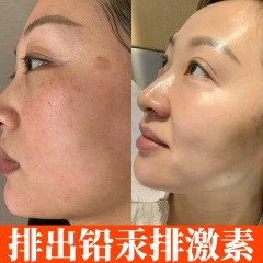 臭い水疎基水排鉛水銀美容院黄褐斑老年斑精華液は肌の色を明るくして黒黄色素に行く