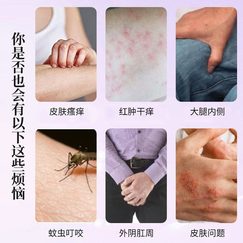 杏坂道枝紫花地丁抑菌膏30g 皮肤瘙痒蚊虫叮咬外用乳膏止痒抑菌膏