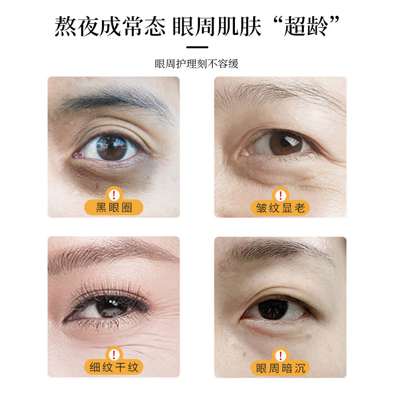 Age-Defying Firming & Anti-Wrinkle Eye Serum Oil (8g) &ndash; Targets Dark Circles, Fine Lines, and Puffy Eyes&mdash;Infused with a Massage-Ready Roller Ball.