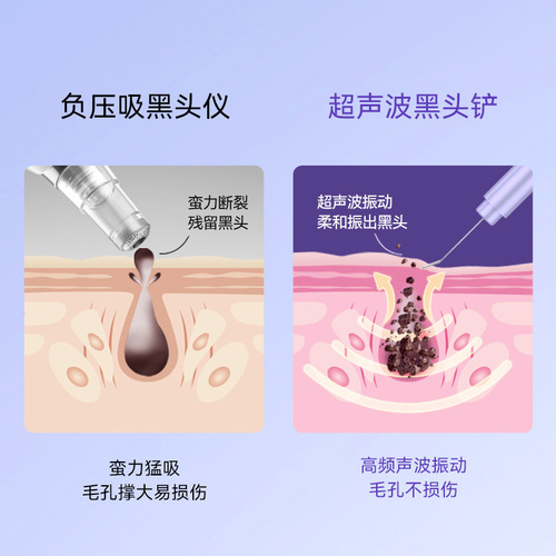 Blackhead removal instrument, ultrasonic peeling machine, beauty instrument, household facial blackhead shovel, pore cleaning and suction tool