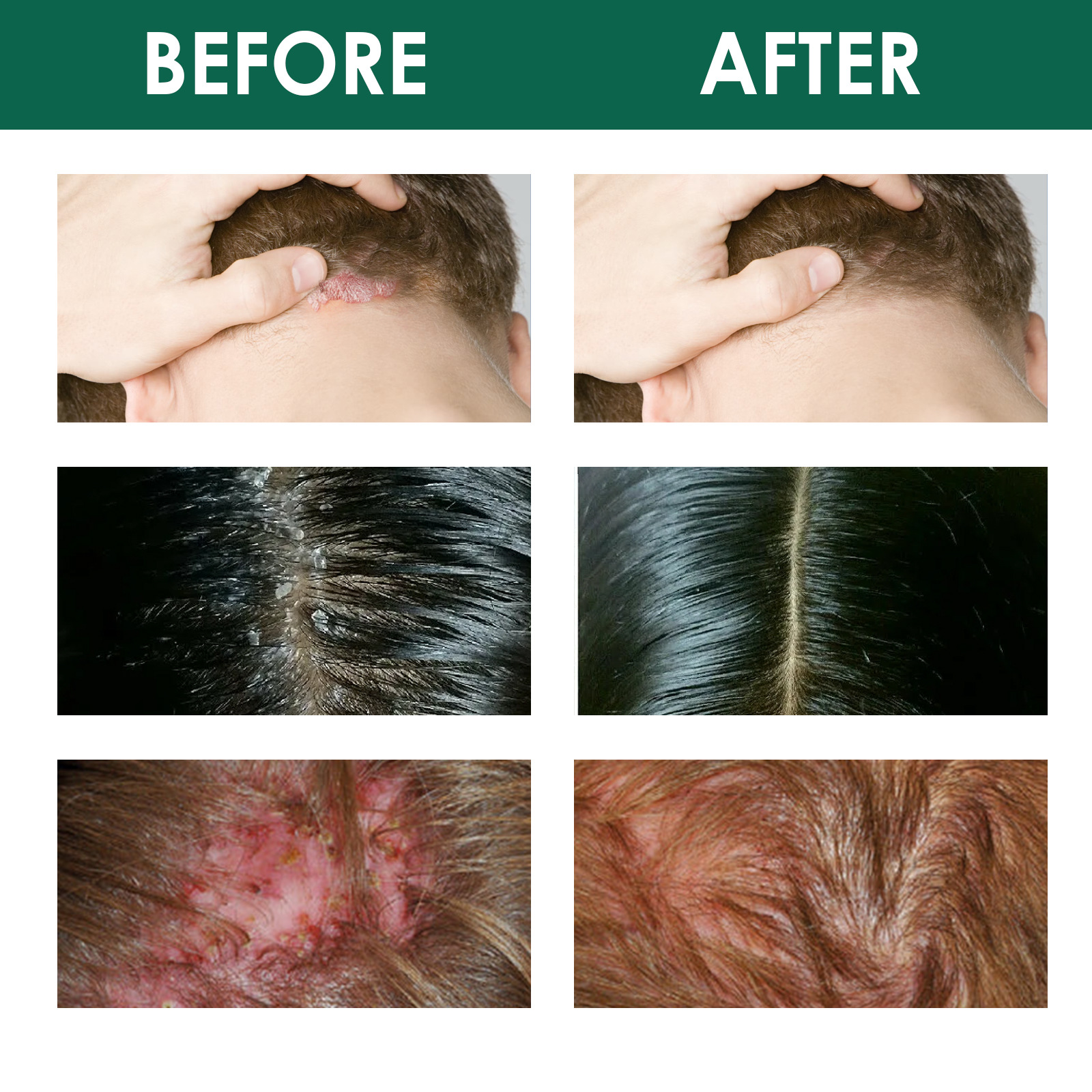 Frizz Control
