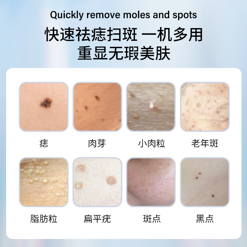 新しい携帯美容院のほくろペン家庭用の白いシミ除去ペン液晶のほくろペンの赤い青い光のほくろ除去ペン|undefined