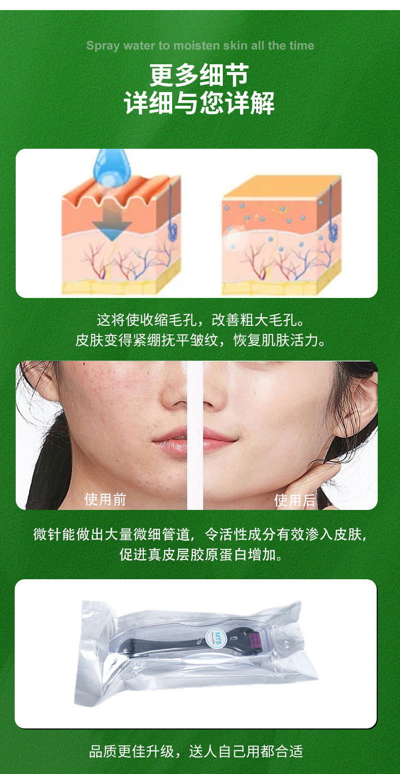 跨境MTS540皮肤滚针微针一次性无菌水光滚轮辅助生发导入美容器械-阿里巴巴