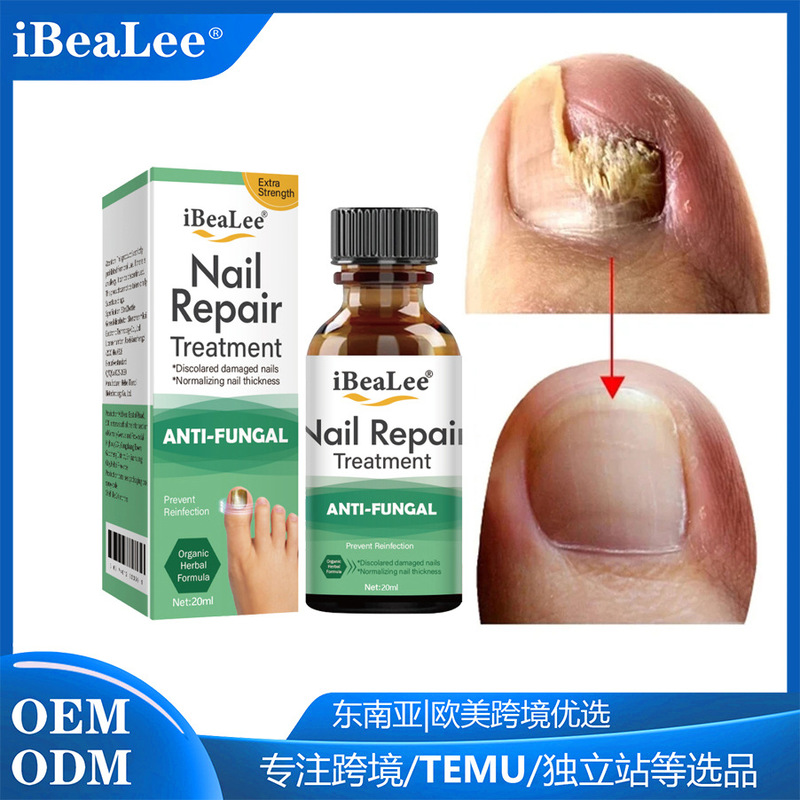 Ibealee灰色爪修復液凹凸軟甲増厚型灰色爪修復液足部亮甲看護液|undefined