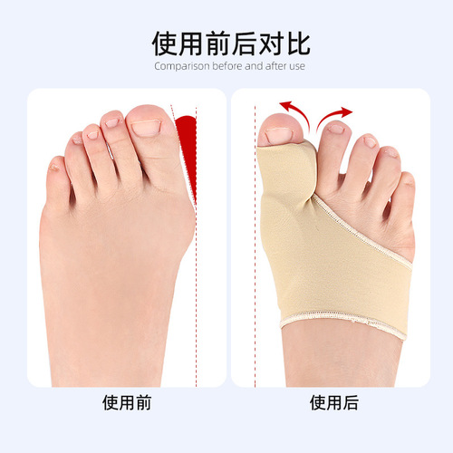 Toe separator toe separator toe cover foot cover toe cover orthosis toe and hallux orthosis