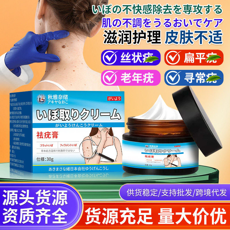 Qiuyanaiwu Wart Removal Cream 30g Is Used for External Application on Skin, Cervical Granules, Flat Warts, Small Black Warts, and External Use