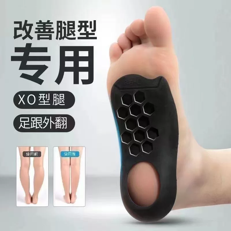 Corrective insoles for legs correction, orthotics, one size 36–45, grey/black