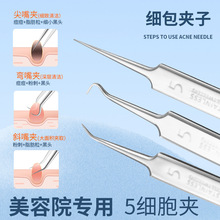 ���P䓼����Aȥ���^��Ӹ߾��ܷ۴�����b����Ժ�D�����]�ڷ۴̊A