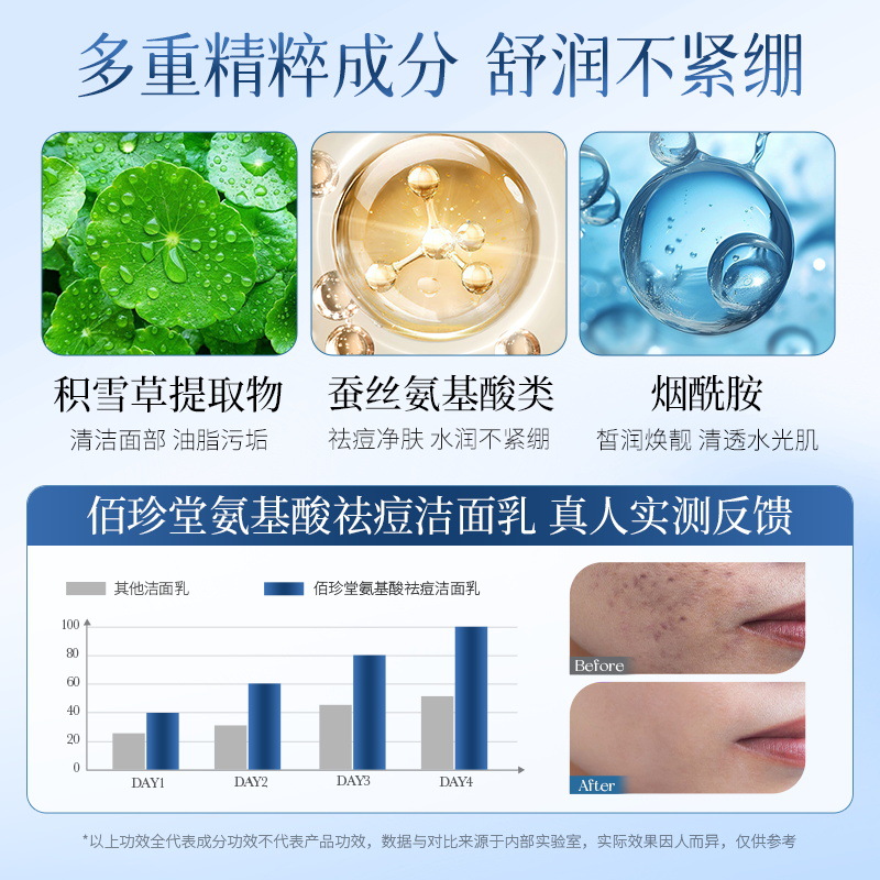 Bai Zhen Tang aminoácidos acné loción facial limpiadora profunda, refrescante, no tensas, mejora de acné loción facial al por mayor
