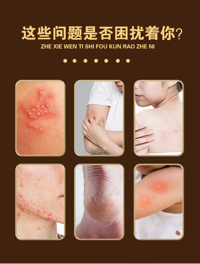 Kuaike Herbal Skin Ointment External Use Bai Cao Gao 20g Box specifications