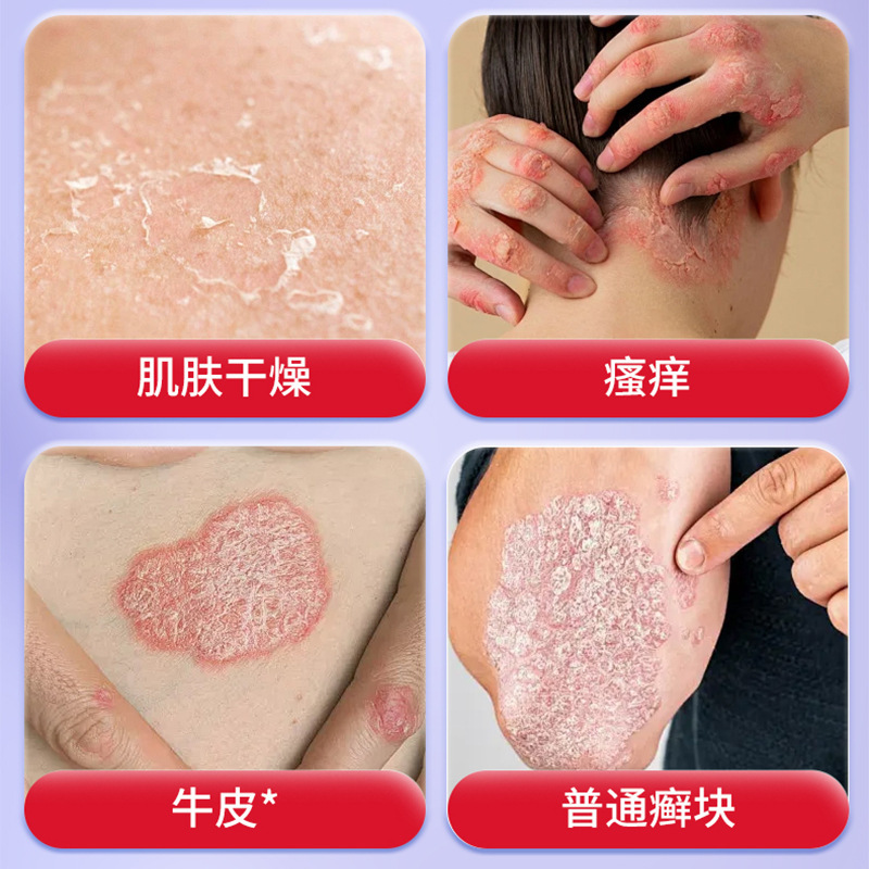 森田久智 牛皮苔型ヘルスケア軟膏 乾燥肌・かゆみ緩和 肌不快感 外用ケア軟膏|undefined