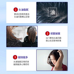 Kawai Hongyan Coal Tar Lotion 50ml Itch-Relieving Oil Control Mild Cleansing Hair Care Anti-Dandruff Hair Care Lotion