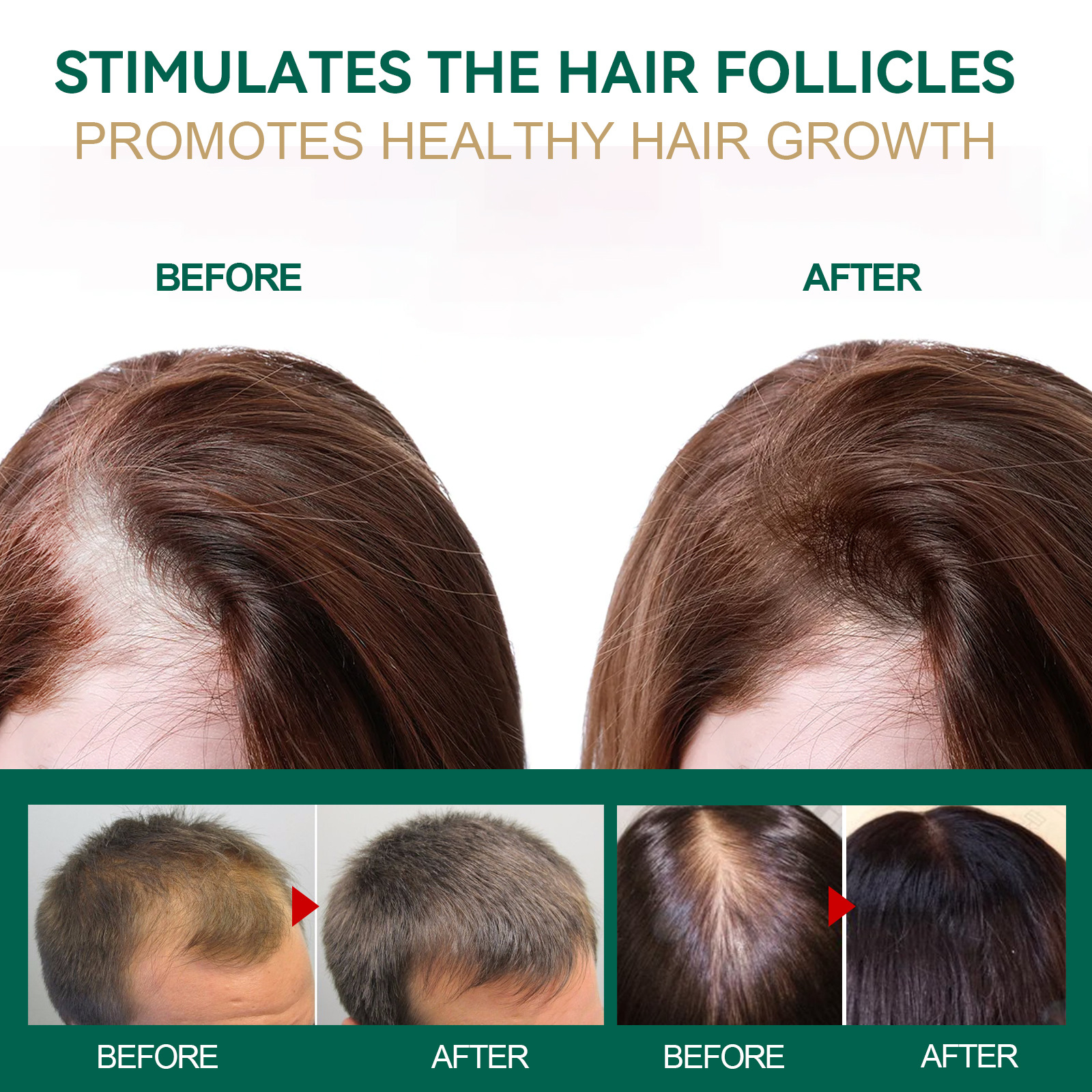 Dense Jaysuing Ginger Hair Essence Cream prevents loss, improves dryness, irritability, nourishes, strengthens_voghion.com