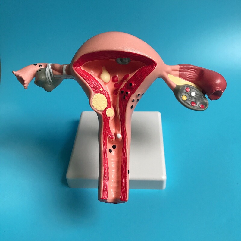 Human Uterus Model Teaching Aid Mold Vagina Ovary Anatomy Pathology Medical Female Simulation Reproductive Model Medical