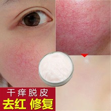 活細胞修護霜角質層激素臉去干燥起皮臉部泛紅褪敏激素臉修復霜