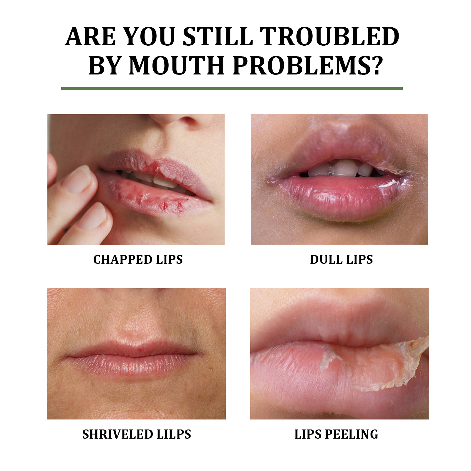 L'aloe EELHOE dissala le linee delle labbra, protegge le labbra dalle screpolature della secchezza e idrata il rossetto_voghion.com