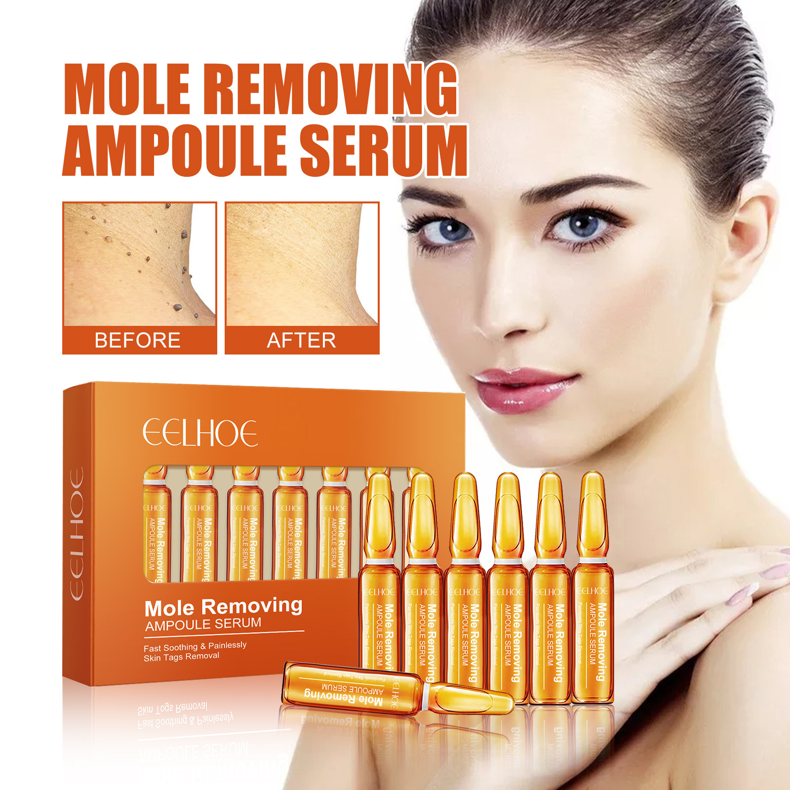 EELHOE Ampolla Anti Nevus Repara y suaviza la piel, desalina la etiqueta de la piel, nevus negro, dermatofito, verruga e_voghion.com