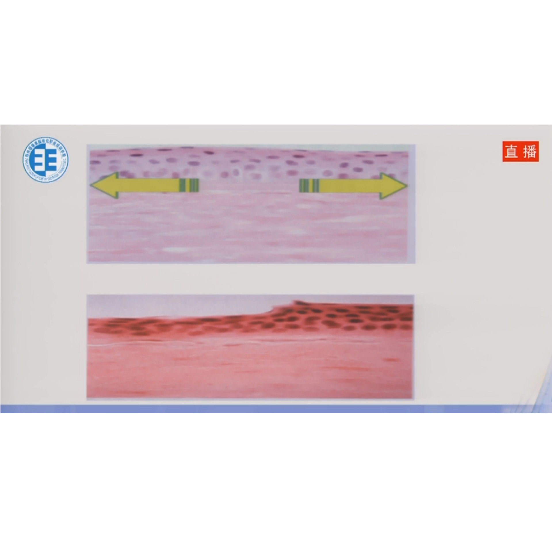 ����������뽹�봦���Բ� �γ�����