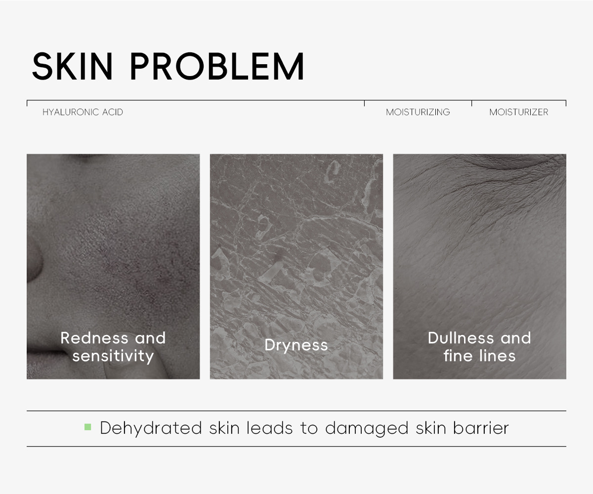 New QUIYUM Hyaluronic Acid Repair Cream 30g Moisturizing, hydrating and hydrating cross-border supply manufacturer, in stock wholesale undefined