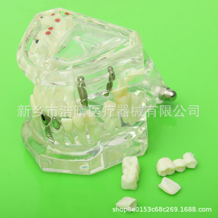 ���ƿɲ�ж��ǻ�ޏ�ģ�� �������Xģ�� ������Nֲ��ģ �B��͸��