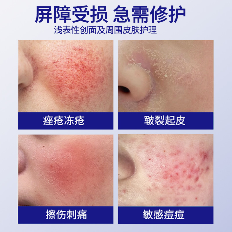 黑战马医用皮肤护理软膏皲裂冻疮痤疮擦伤切割伤小创口定制代加工|undefined