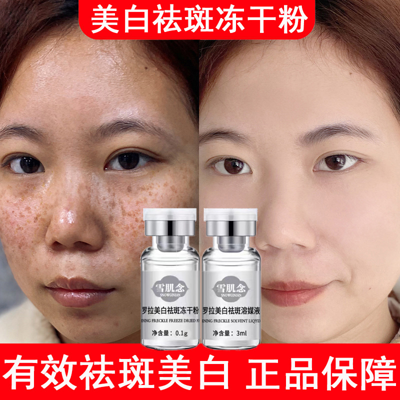 Whitening and freckle removing lyophilized powder to lighten melanin, brighten skin tone, remove yellow spots, freckles, and melasma genuine guarantee