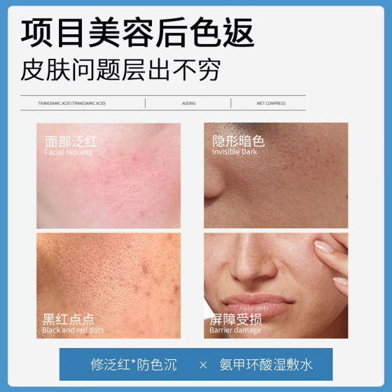 5% tranexamic acid nicotinamide wet compress essence topical tranexamic acid to improve dark and brighten skin tone genuine goods