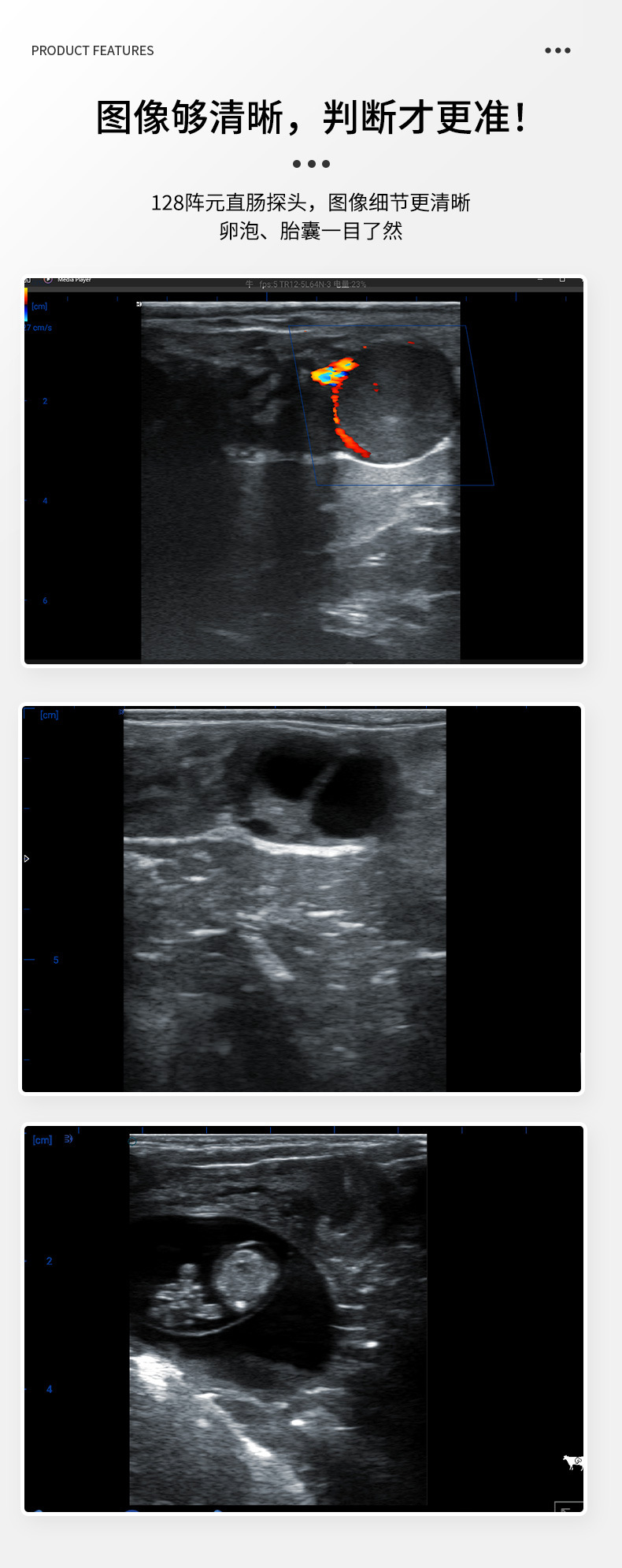 BXL-S300多普勒彩色B超机