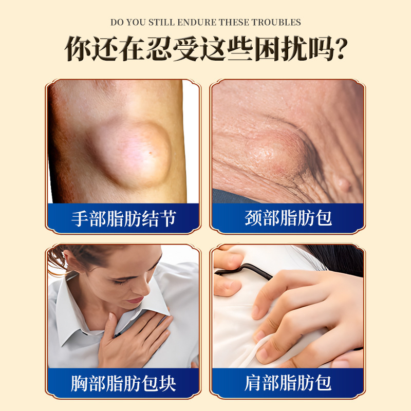 脂肪包膏缓解脂肪包块皮下硬块外用护理膏结节富贵包肿大涂抹膏|undefined