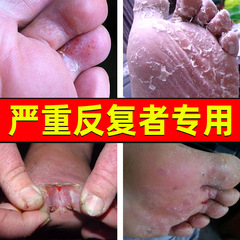 Yang Gong Fang Foot Fungus Spray - Herbal Foot Care Itch and Odor Spray, Wolf Toxicity Batch Development Conference Gift
