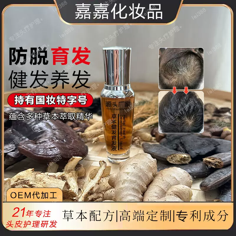 草本头皮养护防脱育发液养发男女发际线发生营养液植物何首乌
