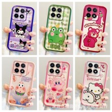 �m��С��14T/15T�֙C���t��15���Lnote13��ͨܛ��NOTE14PRO���o��