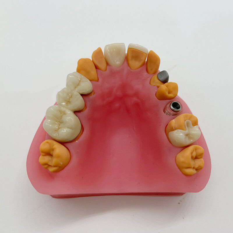 Modelo de Exhibición Dental con Base de Silicona para Enseñanza Mecánica