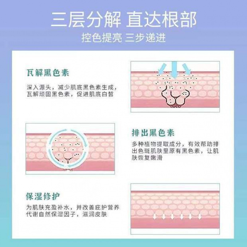 ビューティーサロンのシミ後のカラーコントロールクリームグリーンクリームピコ秒レーザーにきび跡、ほくろ跡、メラニンを軽減|undefined