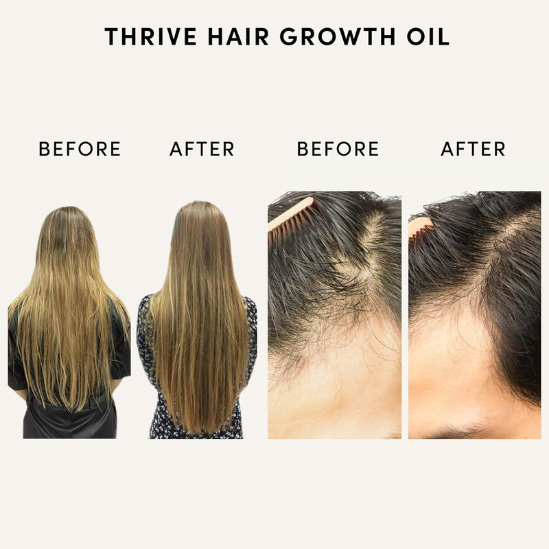 跨境爆款Hair Growth Oil修护受损头发精华液 养发育发精华油|undefined