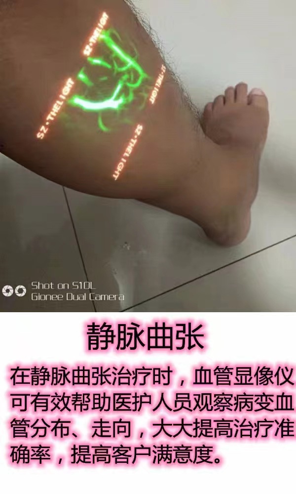 36972abb-9c05-4817-bb67-ba0f0f