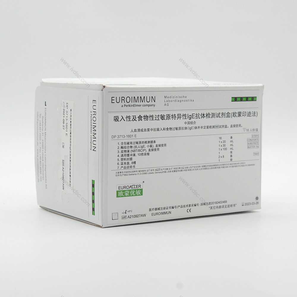 欧蒙 抗肺严衣原体抗体lgM检测试剂盒(酶联免疫吸附法)检验结果准