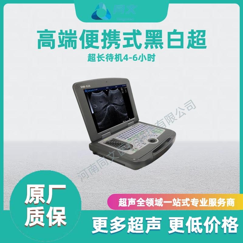 Ultrasonido portátil en blanco y negro Ultrasonido B portátil Ultrasonido B clínica de base Ultrasonido médico en blanco y negro