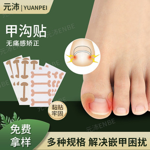 I-Shaped Straight Nail Patch, Nail Groove Inner Roll Stretch, Glue-Free Ingrown Toenail Pad, Nail Self-Adhesive Orthopedic Patch