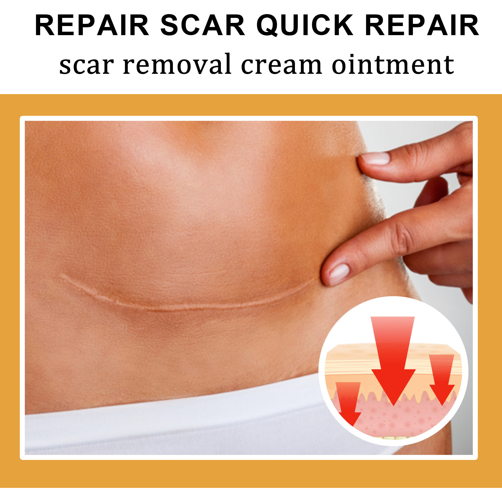 EELHOE Scar Cream Fading Hud Trauma Reparation Forbrænding Forbrænding Fading Cream Kirurgisk reparation Scar Scar Cream_voghion.com