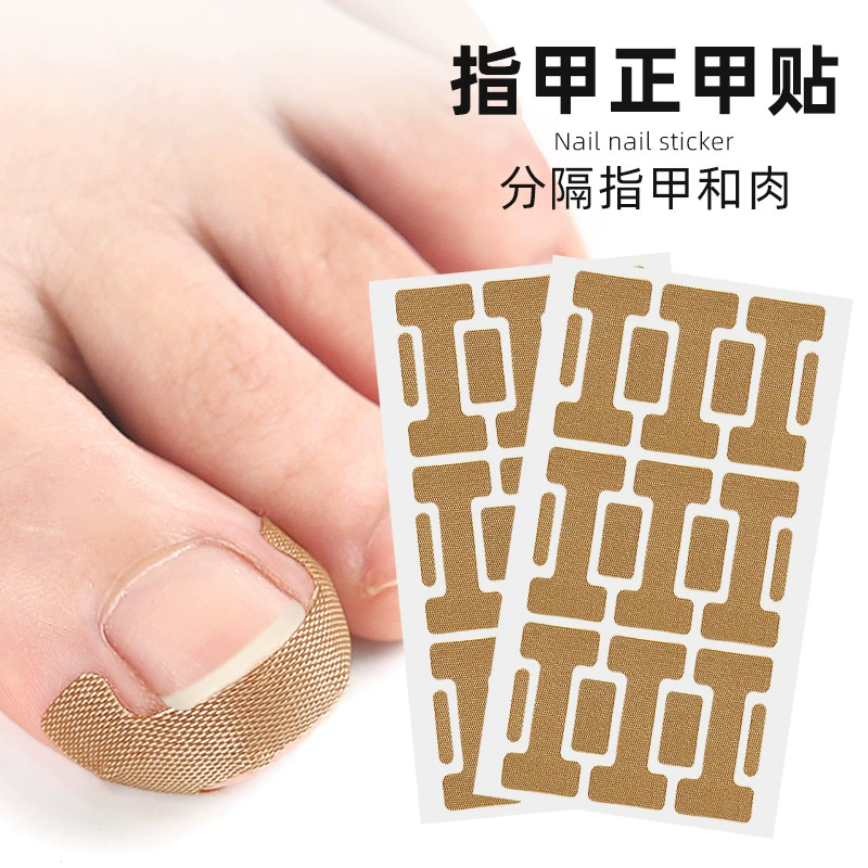 Отрегулируйте внутреннюю рулонную канавку