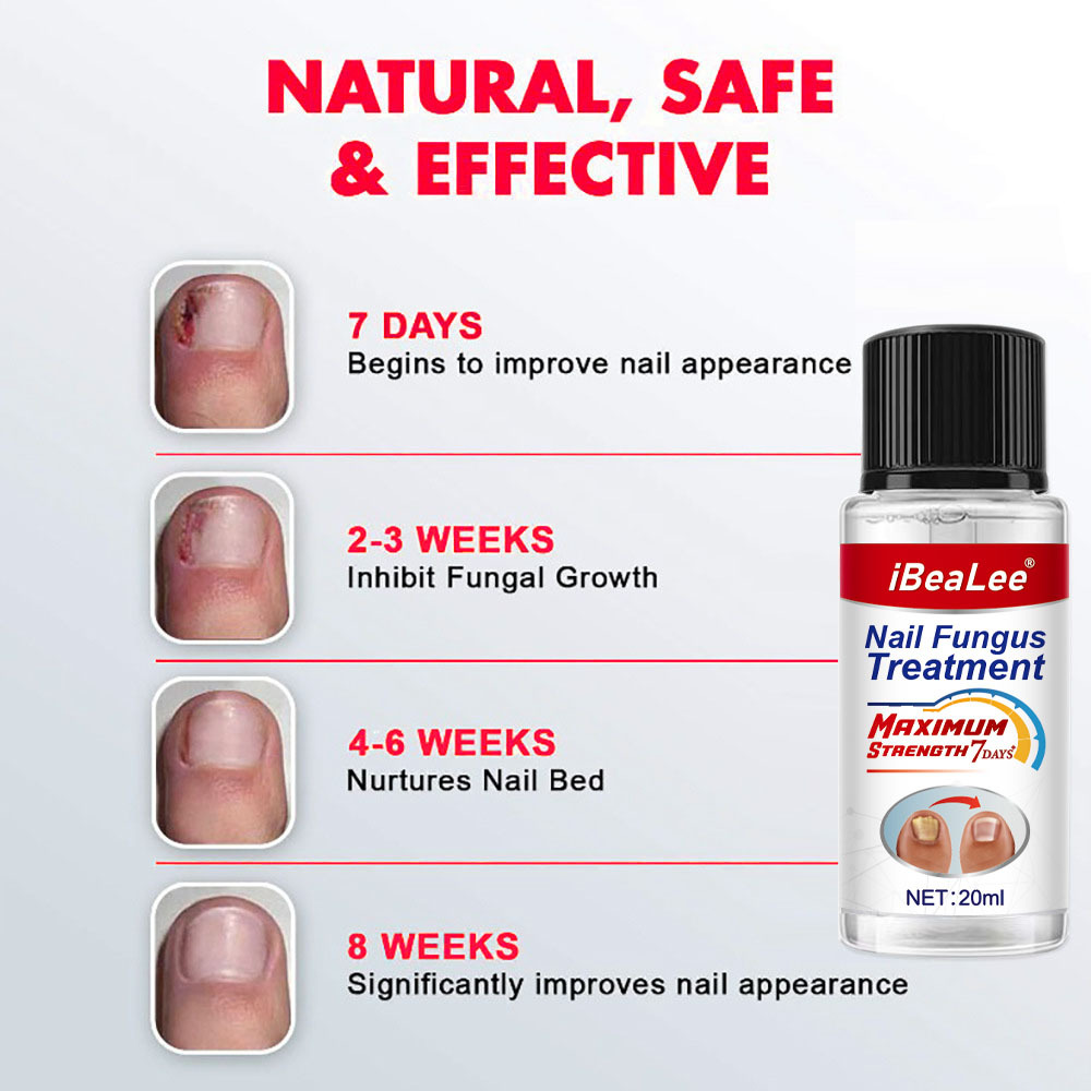 Líquido antibacteriano Crema de eliminación IBeaLee Poción especial espesante para uñas grises suaves_voghion.com