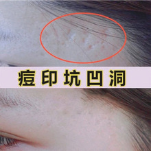 �۲������ӡ���Ӷ��̸఼����������Ք�ë�׵���ȥ��