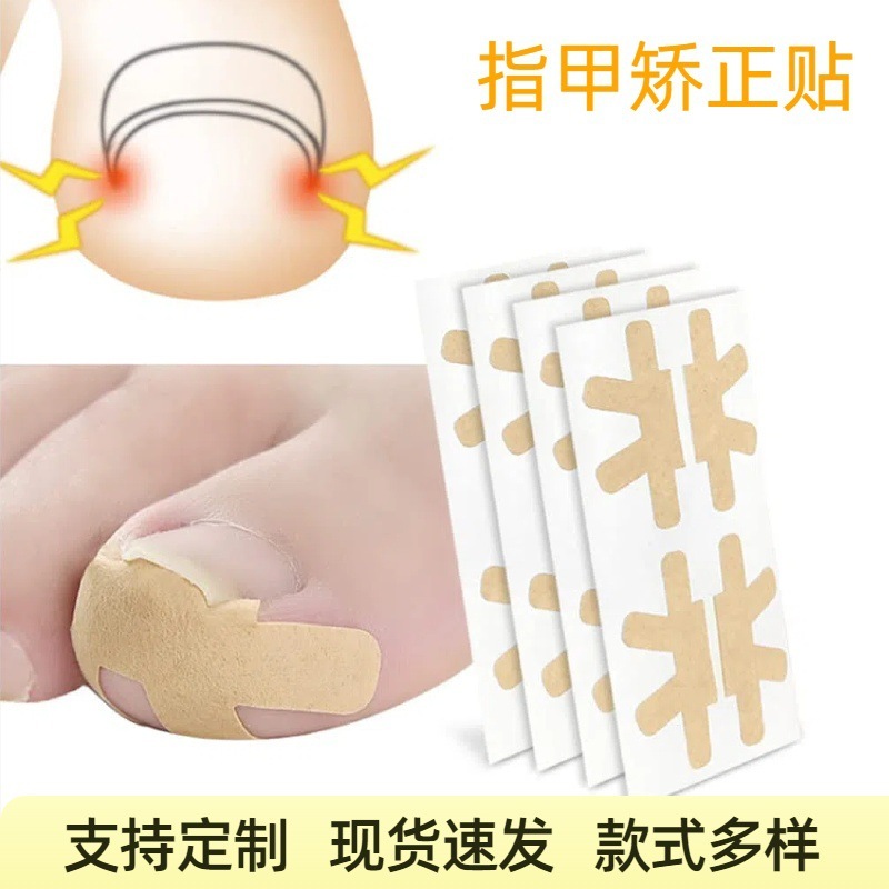 厂家批发脚趾内嵌甲沟缓解贴 指甲脚趾内卷矫正贴 美甲正甲矫正贴|undefined