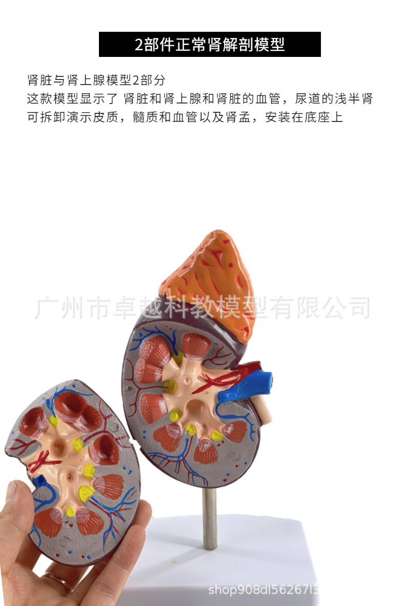 人体肾脏模型 肾解剖附肾上腺放大模型病变肾脏 人体内脏器官解剖-阿里巴巴