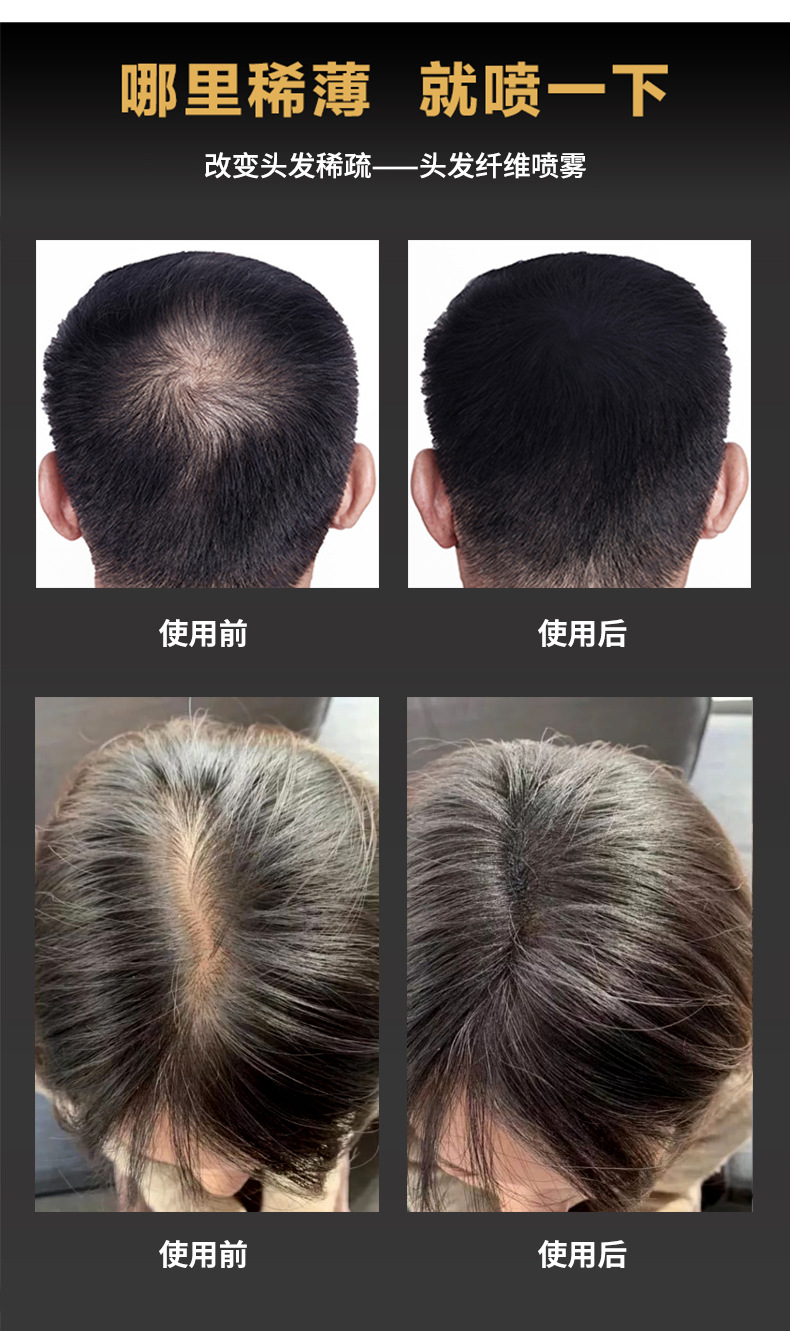 头发纤维详情_07