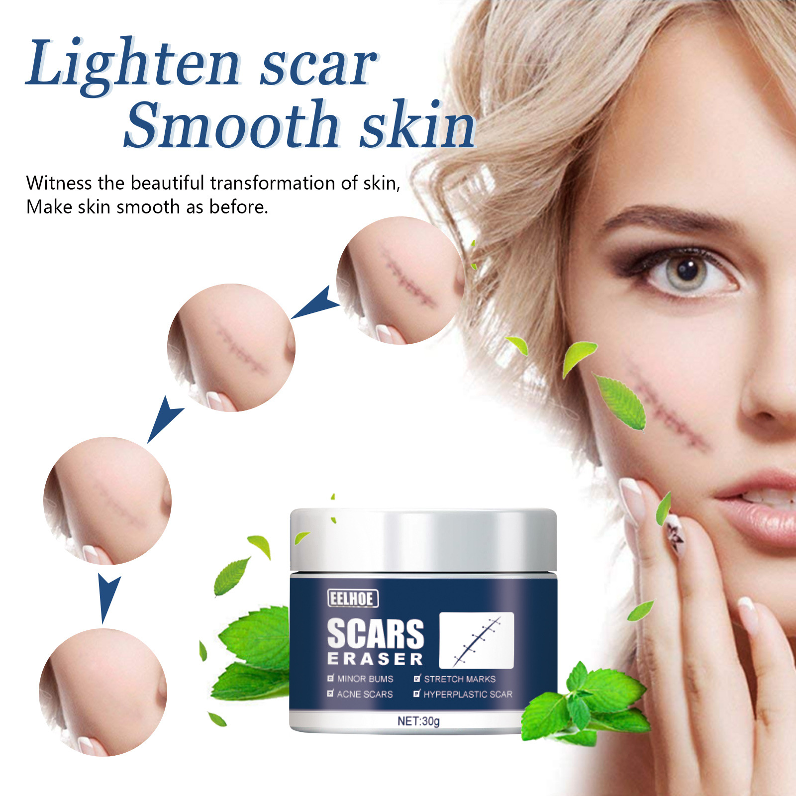 EELHOE – crème anti-cicatrices, compresse froide, cicatrices chirurgicales, réparation des cicatrices, peau lisse, Gel crème, (paquet de 3)_voghion.com