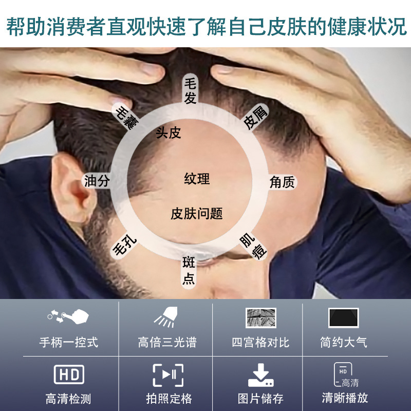 Instrumento de detección de cuero cabelludo pérdida de cabello folículo 3 espectro HD analizador peluquería salón de belleza instrumento de prueba de la piel