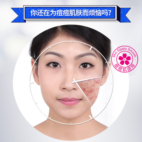 BIOAQUA Qingying Anti-acne Essence Anti-acne Essence Hydrating Moisturizing Facial Essence Wholesale